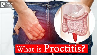 Proctitis Causes Treatment and Surgery  Dr Rajasekhar M R  Doctors Circle [upl. by Koval]