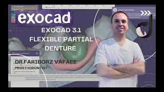 how to design flexible partial denture in exocad31rijkapart1 [upl. by Foah]