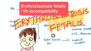 Erythroblastosis fetalis haematology 27 First Aid USMLE Step 1 in UrduHindi [upl. by Centonze]