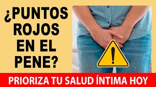 Puntos Rojos En El Glande 💥 Soluciones Efectivas Guía Práctica Sobre La Balanitis [upl. by Cassil]