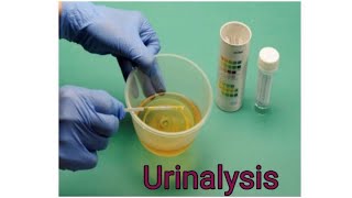 URINALYSIS  How to perform Urinalysis  Urine Dipstick [upl. by Eleira]