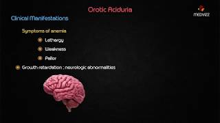 Orotic aciduria  Usmle biochemistry case based discussion [upl. by Airitac622]