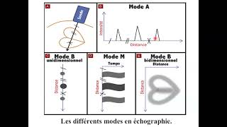 2 Echographie 7eme partie [upl. by Lleddaw613]