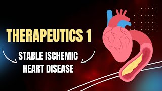 Therapeutics1  stable Ischemic Heart Disease [upl. by Ebeneser]