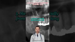 Jaw Bone Mysteries SOLVED Radiologist Reveals All  Lytic bony lesions of Mandible amp Maxilla [upl. by Wanids761]