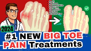 1 Big Toe Joint Pain Cure Arthritis Sesamoiditis Turf Toe Gout [upl. by Aloisius279]