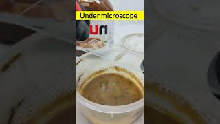 Under microscope viralreelschallenge undermicroscope youtubeviralshorts [upl. by Aidnyc]