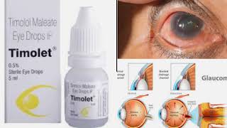 TIMOLET  Timlol maletate eye drop IP  glaucoma  IOP  Uses  side effect  Optometry solution [upl. by Lashonde]