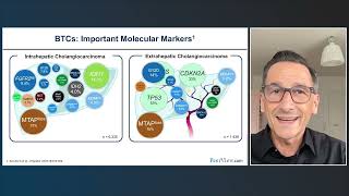 Immunotherapy in Advaced BTC Standardizing Team Based Strategies With Immune Checkpoint Inhibitors [upl. by Enehpets]