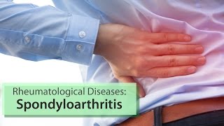 Rheumatological Diseases Spondyloarthritis [upl. by Shorter888]