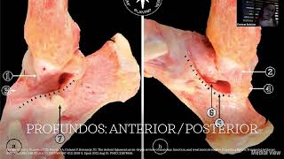 Webinar Lesión de ligamento deltoideo en fracturas de tobillo [upl. by Eecats]