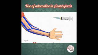 💉 HOW TO USE ADRENALINE EPINEPHRINE IN ANAPHYLAXIS  pediatrics medicine epinephrine [upl. by Far]