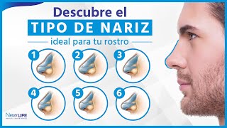 Descubre qué tipo de nariz es la ideal a tu tipo de rostro  EN VIVO Corrección de Nariz Sin Cirugí [upl. by Hitt]