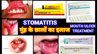 Stomatitis  मुंह के छाले का इलाज  Mouth Ulcer Treatment  Stomatitis In Hindi Muh K Chale Ka Ilaj [upl. by Garnette]