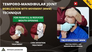 TMJ MOBILIZATION WITH MOVEMENT TECHNIQUE FOR TREATING PAINFUL AND REDUCED MOUTH OPENING [upl. by Dranoc]