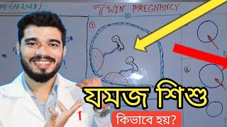 যমজ সন্তান কিভাবে হয়  What is Dichorionic and Monochorionic twin pregnancy [upl. by Richmal]