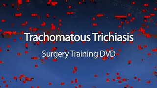 Trachomatous Trichiasis TT Surgery Training for Health Care Workers trachoma eyehealth who [upl. by Honeyman684]