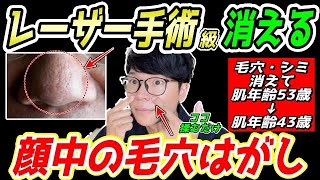 【毛穴・シミ解消して53歳⇨43歳✨】ガチガチの顔の筋肉をふにゃふにゃにして毛穴解消！顔のシミ、ほうれい線、マリオネットライン、ゴルゴラインも解消！首コリ・肩こり・頭痛も消える！ [upl. by Connel732]