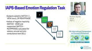 Norman Spivak  Transcranial Focused Ultrasound May Disrupt Amygdalar Function 2020 [upl. by Abbottson754]