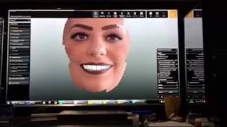 Zirkonzahn FaceHunter  Dentics Cancun [upl. by Alekim151]