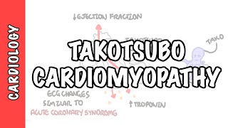 Takotsubo Cardiomyopathy Broken heart syndrome  pathophysiology diagnosis and treatment [upl. by Havens451]