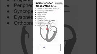 Indications for preoperative EKG [upl. by Enerak29]