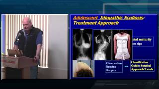 Decision Making in Adult Spinal Deformity [upl. by Johnsten]