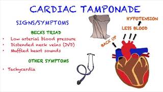 Cardiac Tamponade [upl. by Ontina]