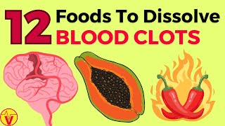 12 Foods That Dissolve Blood Clots Naturally Doctors WONT Tell You  VisitJoy [upl. by Javier15]