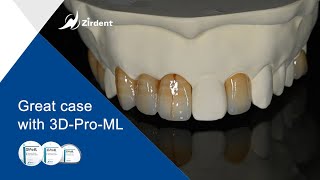 Zirdent 3DProML Zirconia Block Case After StainampGlaze [upl. by Asor]