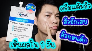 รีวิว ครีมแต้มสิวยันฮี สิวยุบใน 3 วัน รีวิวจริงไม่มีจัดฉาก [upl. by Kinnon]