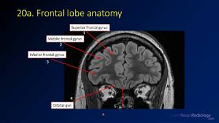 Neuroradiology review  brain gyral anatomy [upl. by Koby]