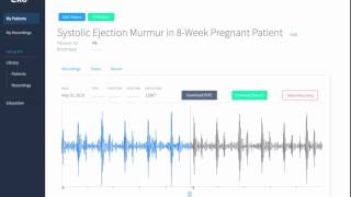 Systolic Ejection Murmur in 8Weeks Pregnant Patient Recording amp Waveform  Eko Health [upl. by Eirallam987]