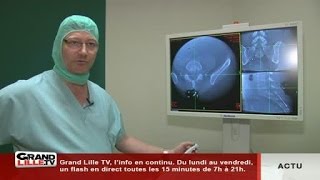 Objectif Santé  La chirurgie du rachis assistée par Ordinateur à Lille [upl. by Consalve]