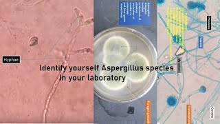 Aspergillus in KOH mount grow on SDA LPCB Preparation showing CondiaConidiophoresPhialides [upl. by Yrrak683]