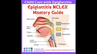 Epiglottitis For NCLEX epiglottitis education nursingexam nclexquestions nclexpreparation eaxm [upl. by Dachi]