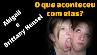 Como estão as gêmeas siamesas mais famosas do mundo  Abigail e Brittany Hensel [upl. by Oek965]