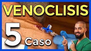 VENOCLISIS – Parte 5 CASO REAL 5 Cómo CANALIZAR una VENA [upl. by Chloris]