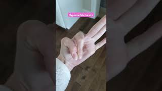 Hypermobile hands Can you do this ehlersdanlos hypermobile eds bendy tricks hands fingers [upl. by Nihsfa]