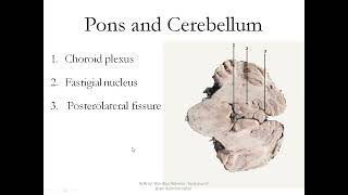 Anatomy demonstration of parts of the Brain part 1 [upl. by Nirtiac]