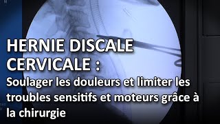 Hernie discale cervicale  soulager les douleurs et limiter les troubles sensitifs et moteurs [upl. by Ennahgiel273]