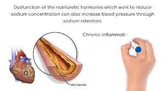 Pathophysiology Hypertension [upl. by Colson971]