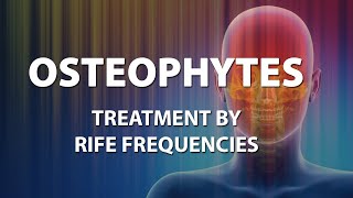 Osteophytes Bone Spurs  RIFE Frequencies Treatment  Energy amp Quantum Medicine with Bioresonance [upl. by Rorrys]