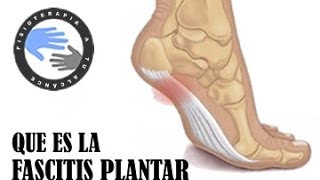 Fascitis plantar que es y como se produce [upl. by Hammock]