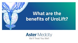 Benefits of UroLift Treatment [upl. by Aissat27]