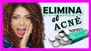 Como quitar el ACNE y las MANCHAS Rapido ♥  Mascarilla Casera 💗 YOLIANA GAMBOA [upl. by Evered]