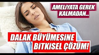 Dalak büyümesi bitkisel tedavi yöntemleri ve öneriler [upl. by Yekim328]