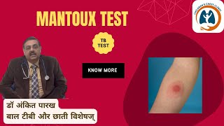 Mantoux Test मंटौक्स टेस्ट or Tuberculin Skin Test I डॉ अंकित पारख बाल टीबी और छाती विशेषज् [upl. by Eliath]