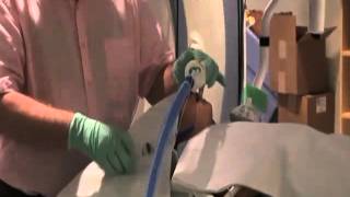 Laryngeal Mask Airway LMA Insertion in Pediatrics [upl. by Enneirb819]