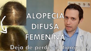 Alopecia difusa femenina mejor tratamiento dermatologo te lo explica [upl. by Aver]